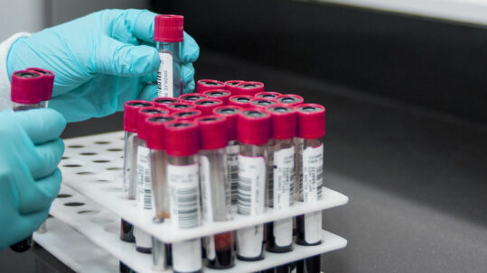 mpox test kits